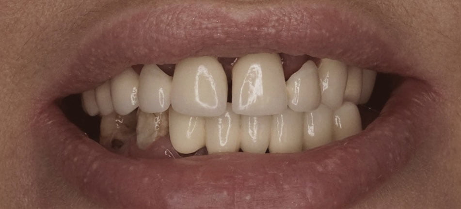 Before image
