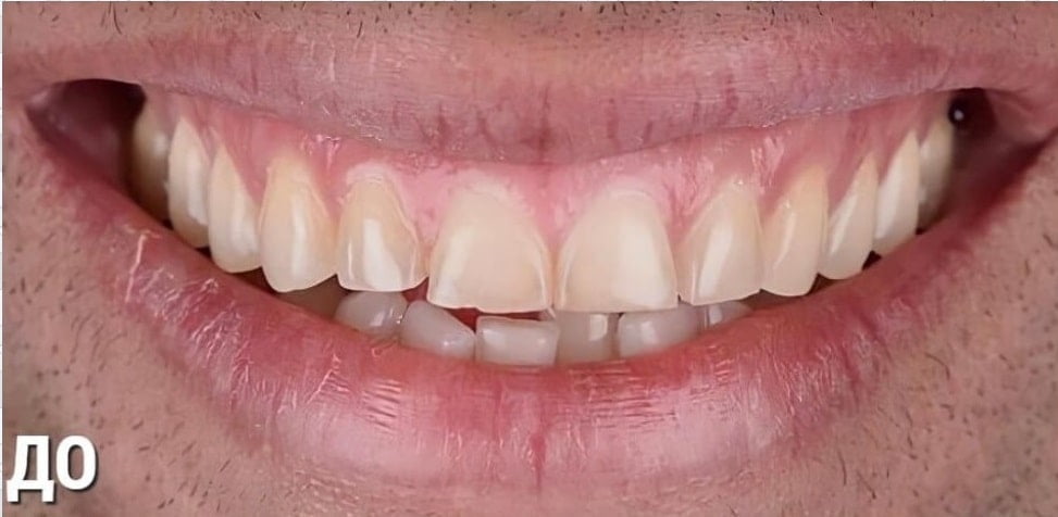 Before image