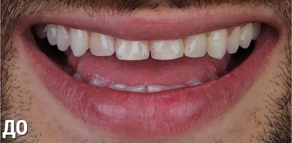 Before image